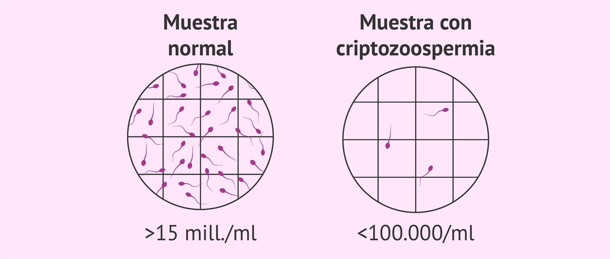 Antiabortivo y descendencia
