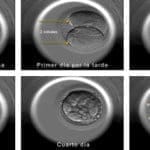 Entrevista en IMF al Dr. José Muñoz sobre: “El embryoscope”