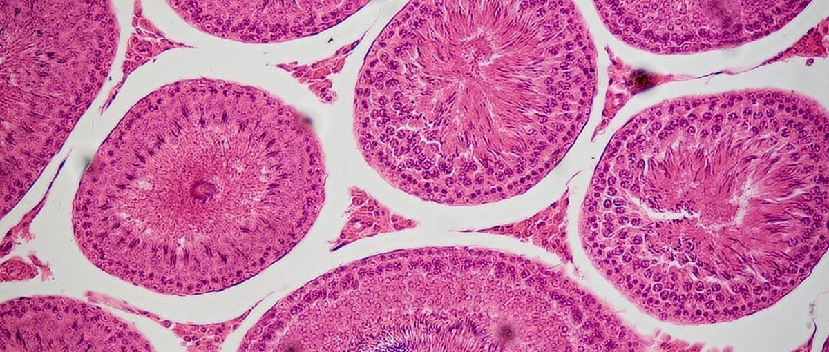 Interior de los testículos en azoospermia Túbulos seminíferos en azoospermia