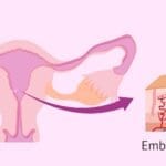 Implantación embrionaria