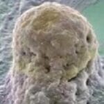 Morfología del blastocisto, anomalías cromosómicas y género del embrión