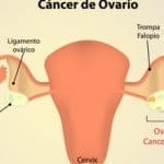 Cáncer y reproducción asistida