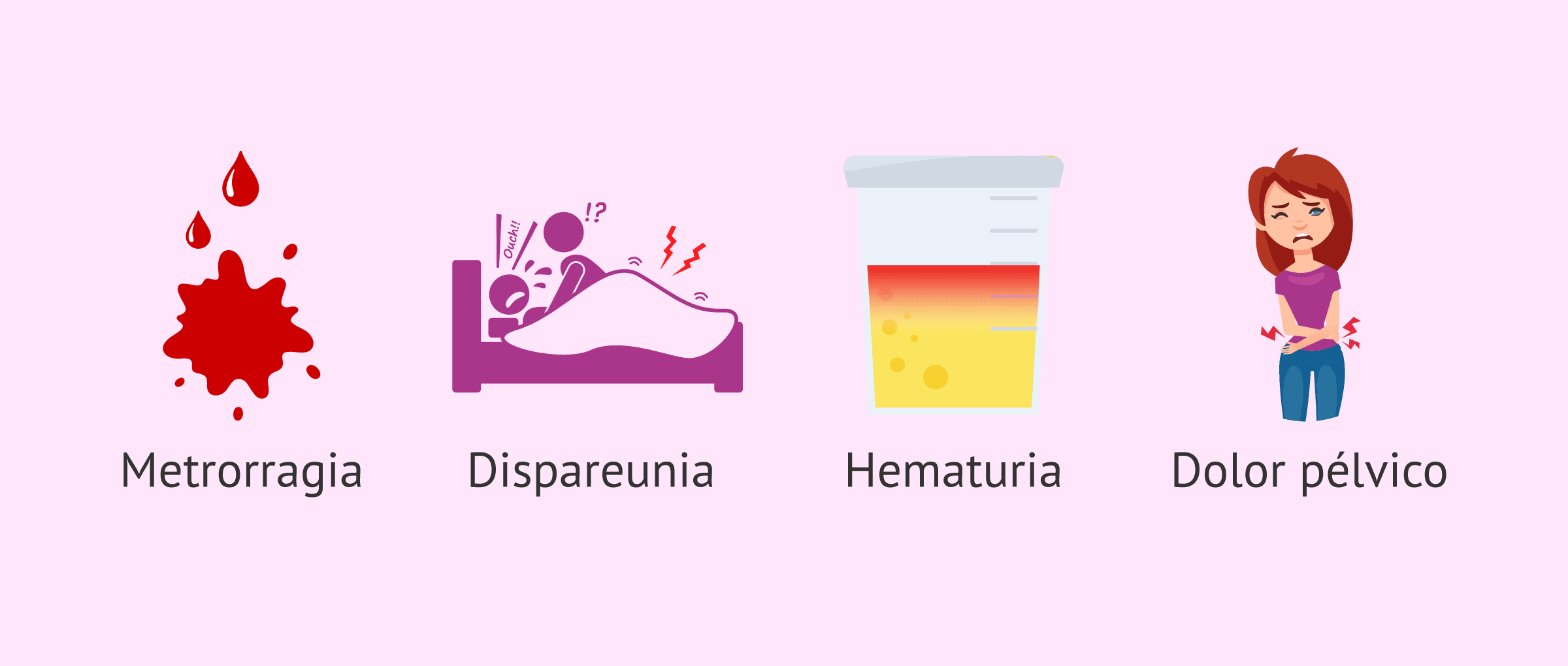 Endometriosis