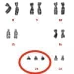 Anomalías citogenéticas y reproducción asistida