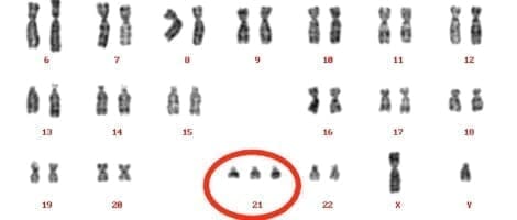 Anomalías citogenéticas y reproducción asistida