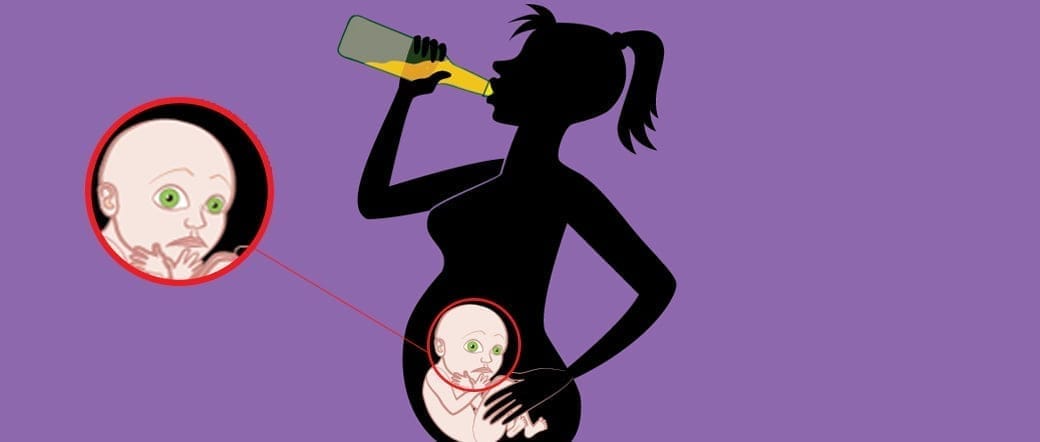 El consumo de alcohol durante el embarazo es el principal causante de defectos de nacimiento en los niños