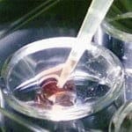 Las posibilidades de un embarazo exitoso por fecundación in vitro disminuyen con el uso de semen congelado