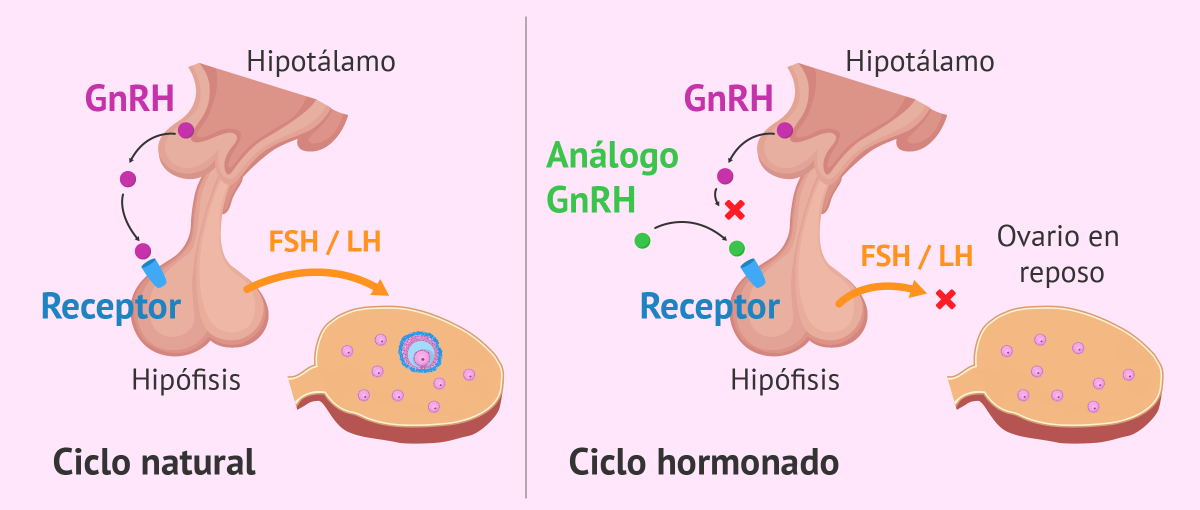 Cuáles son lis síntomas que nos indican que estamos padeciendo Assisted hatching