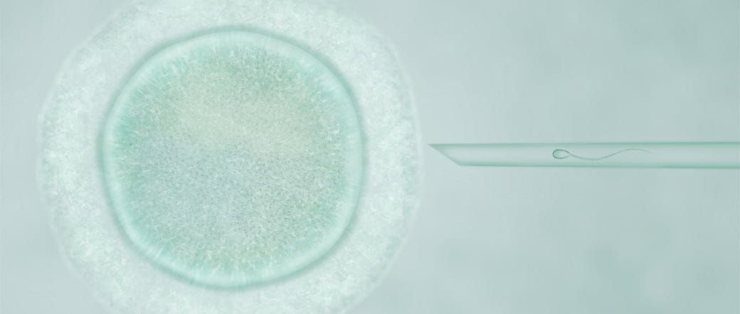 Los problemas cardiovasculares son más frecuentes en niños nacidos por fecundación in vitro