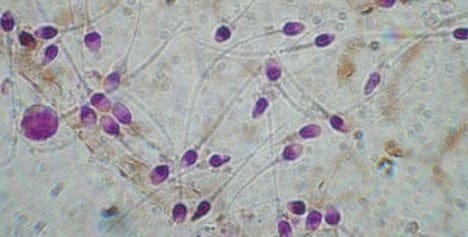 A partir de los resultados obtenidos del seminograma y de la capacitación espermática se realiza un diagnóstico y se aconseja una técnica de reproducción asistida adecuada al problema de esterilidad de la pareja.