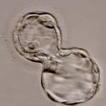 Edad y desarrollo del blastocisto