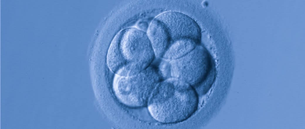 Transferencia embrionaria