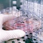 Endometrio