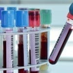 Un nuevo tratamiento permite restablecer la ovulación en la mujer, que recupera la fertilidad