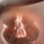 Parto vaginal y mellizos