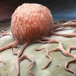 Placenta y duración del embarazo