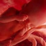 El Ministerio de Sanidad propone financiar en toda España el diagnóstico genético preimplantacional, técnica empleada en tratamientos de reproducción asistida