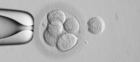 tecnicas de reproduccion asistida