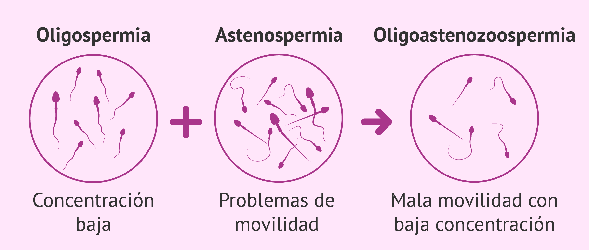 Diagnóstico de oligoastenozoospermia