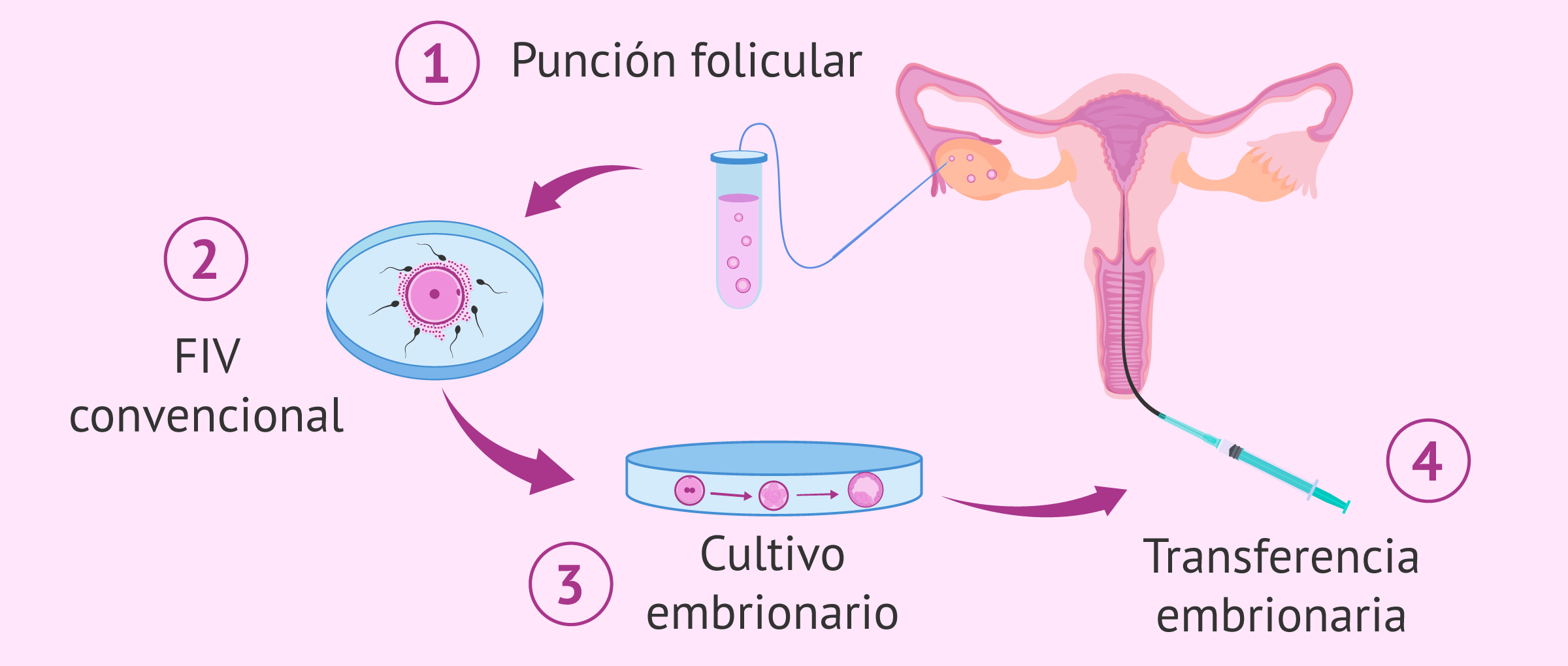 Fecundación in vitro convencional