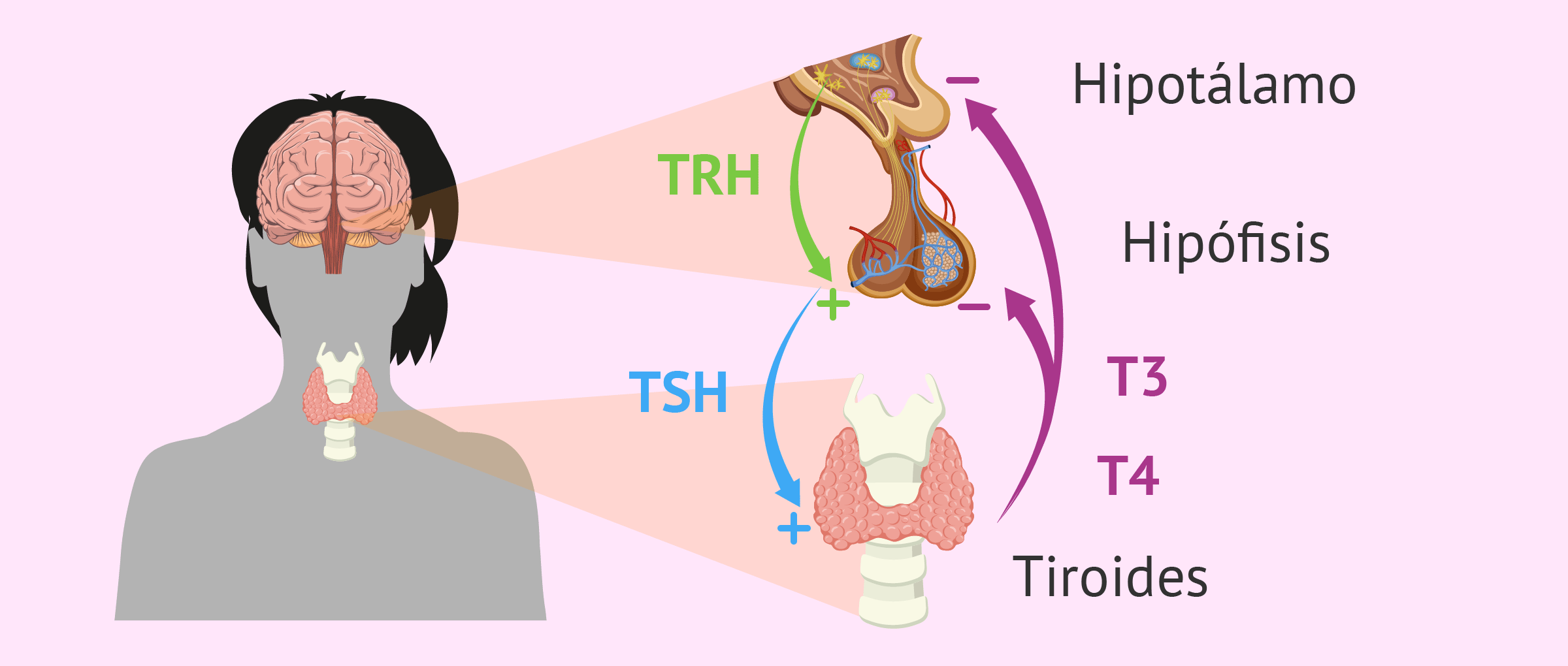 Trastornos en la glándula tiroides
