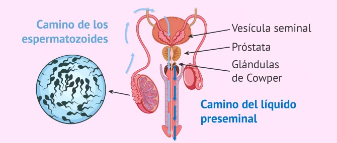 Boquilla Equivalente Fascinante Espermatozoides en líquido preseminal: ¿hay probabilidad de embarazo?