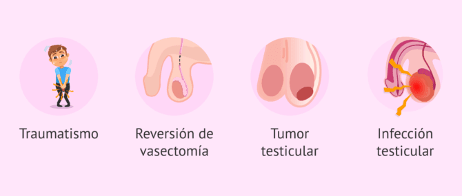Imagen: causas-aglutinacion-espermatozoides-faq
