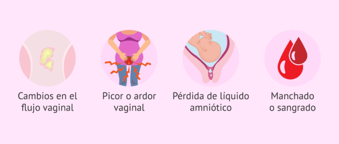 Imagen: Cuándo consultar las secreciones vaginales con el ginecólogo