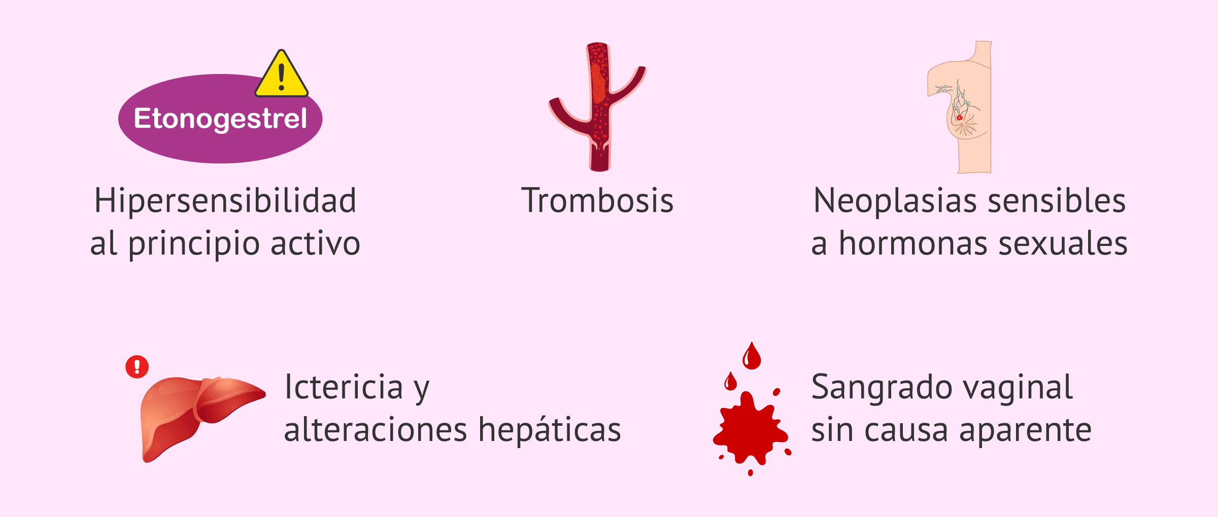 Imagen: Contraindicaciones del uso de Implanon