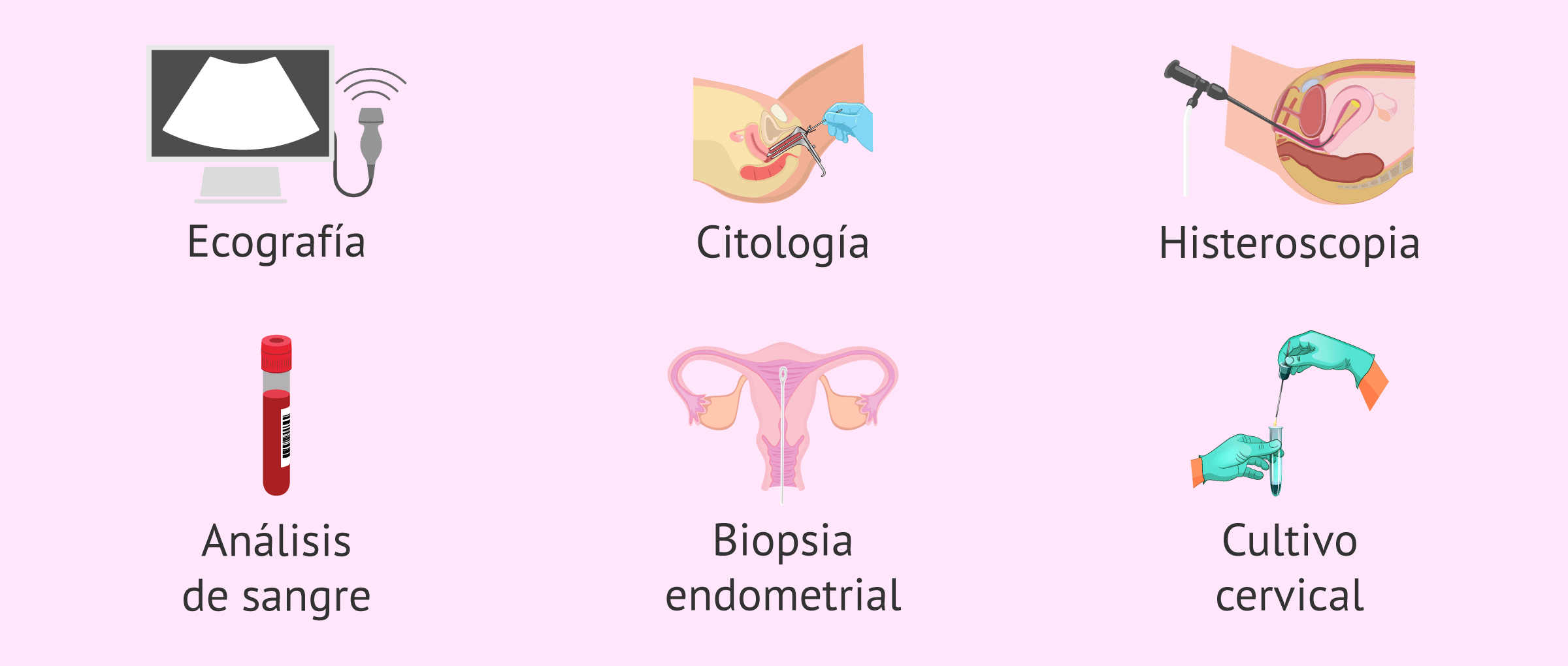Diagnóstico del sangrado intermenstrual