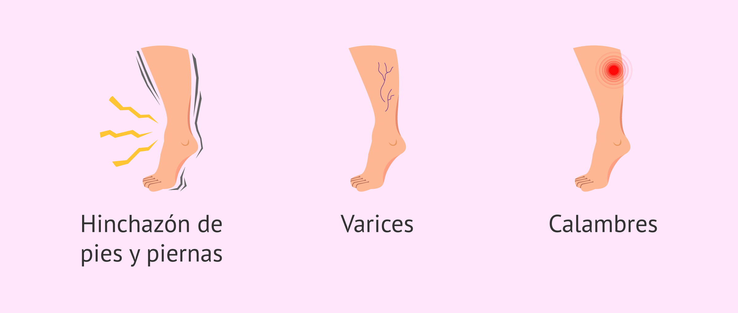 Molestias comunes en las piernas durante el embarazo