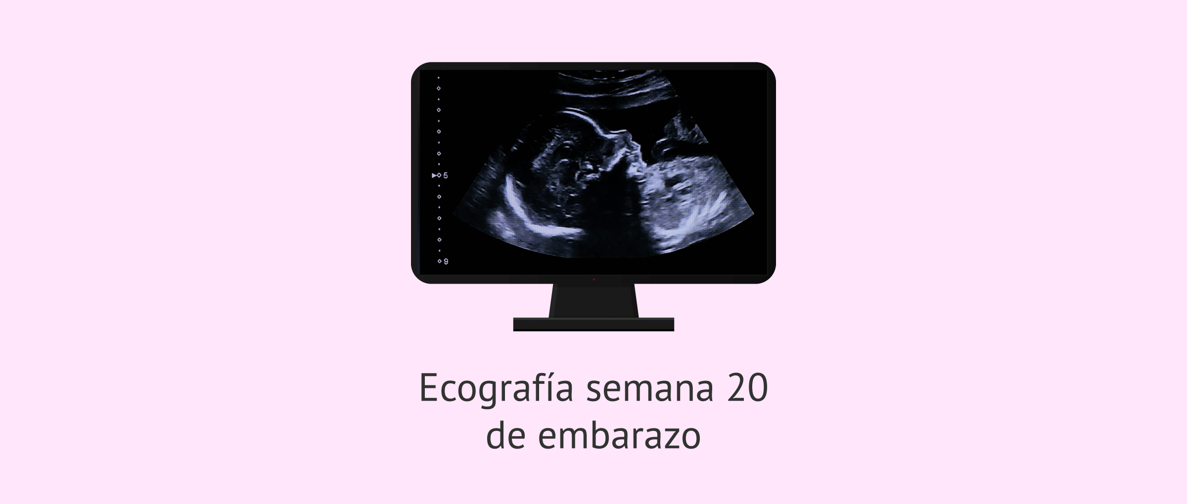 Ecografía en la semana 20 de embarazo