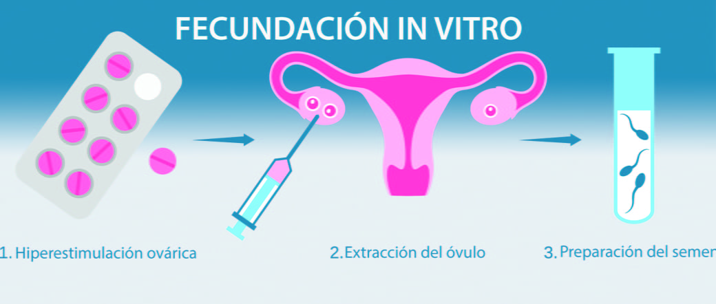 Una fecundación in vitro exitosa depende de muchos factores