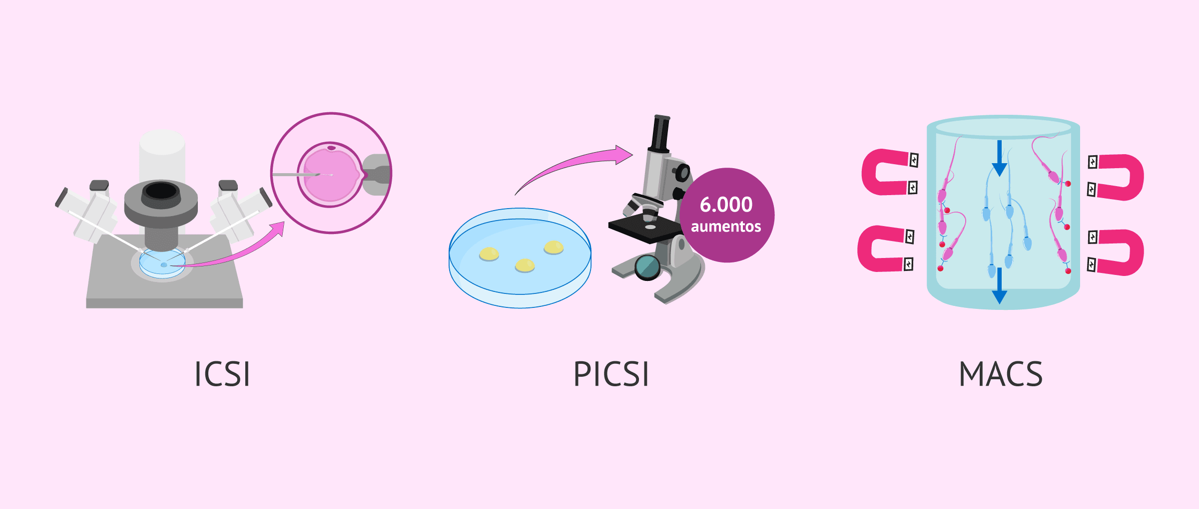 Imagen: Diferentes técnicas de selección espermática