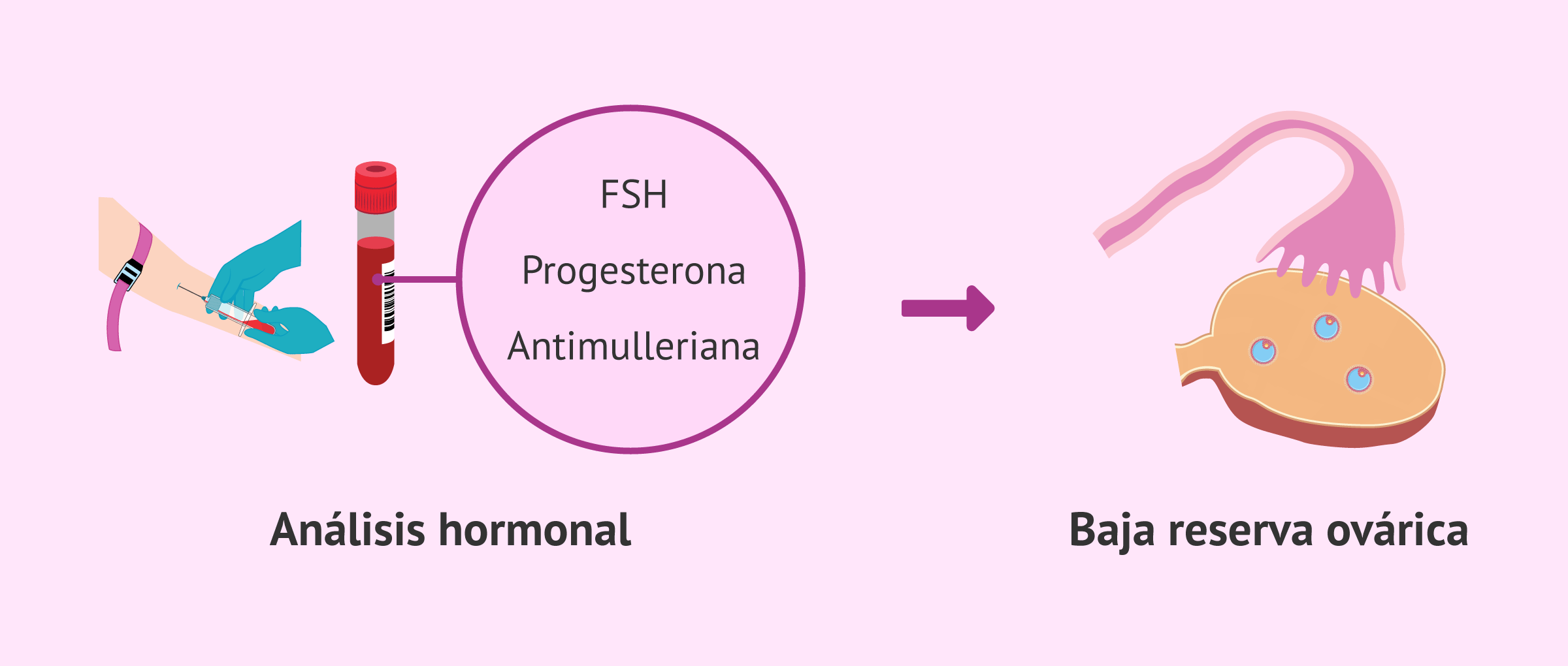 hormonas-baja-reserva-ovarica