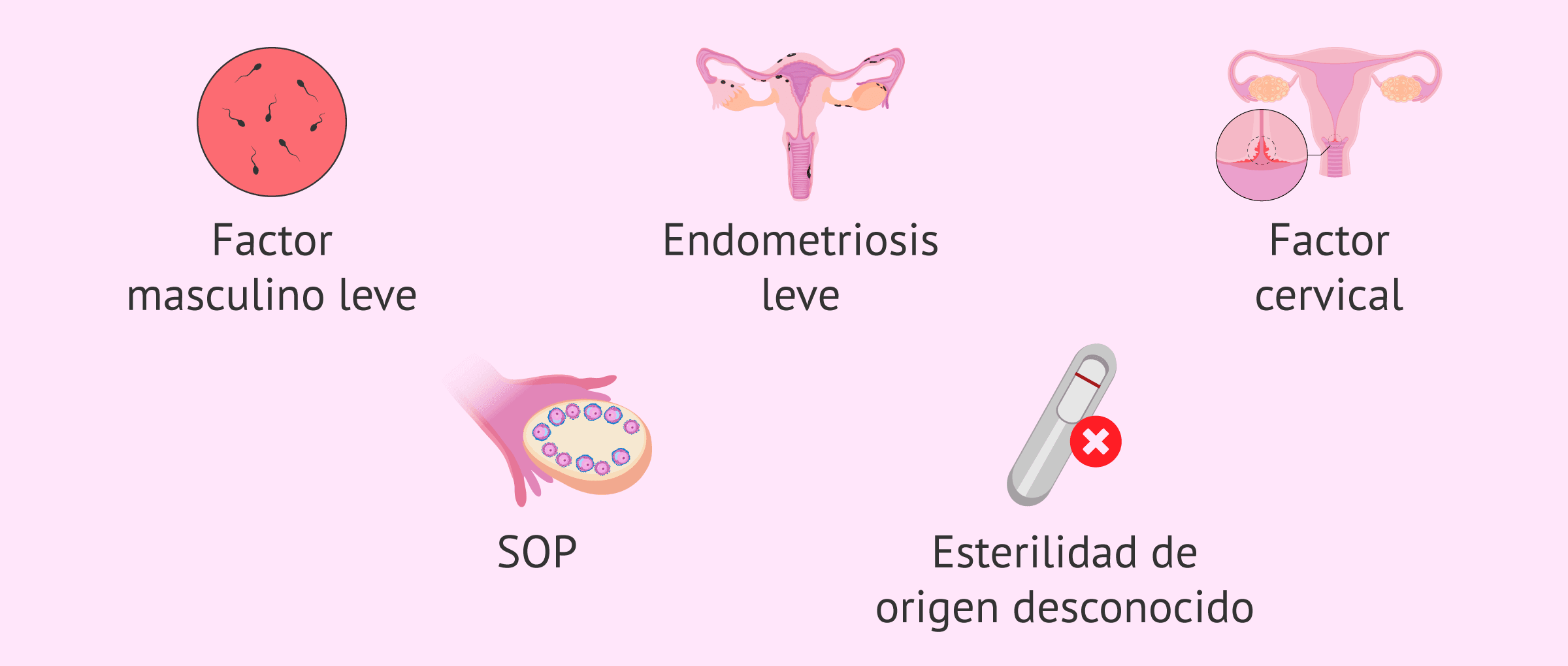 Imagen: Indicaciones para hacer una IA
