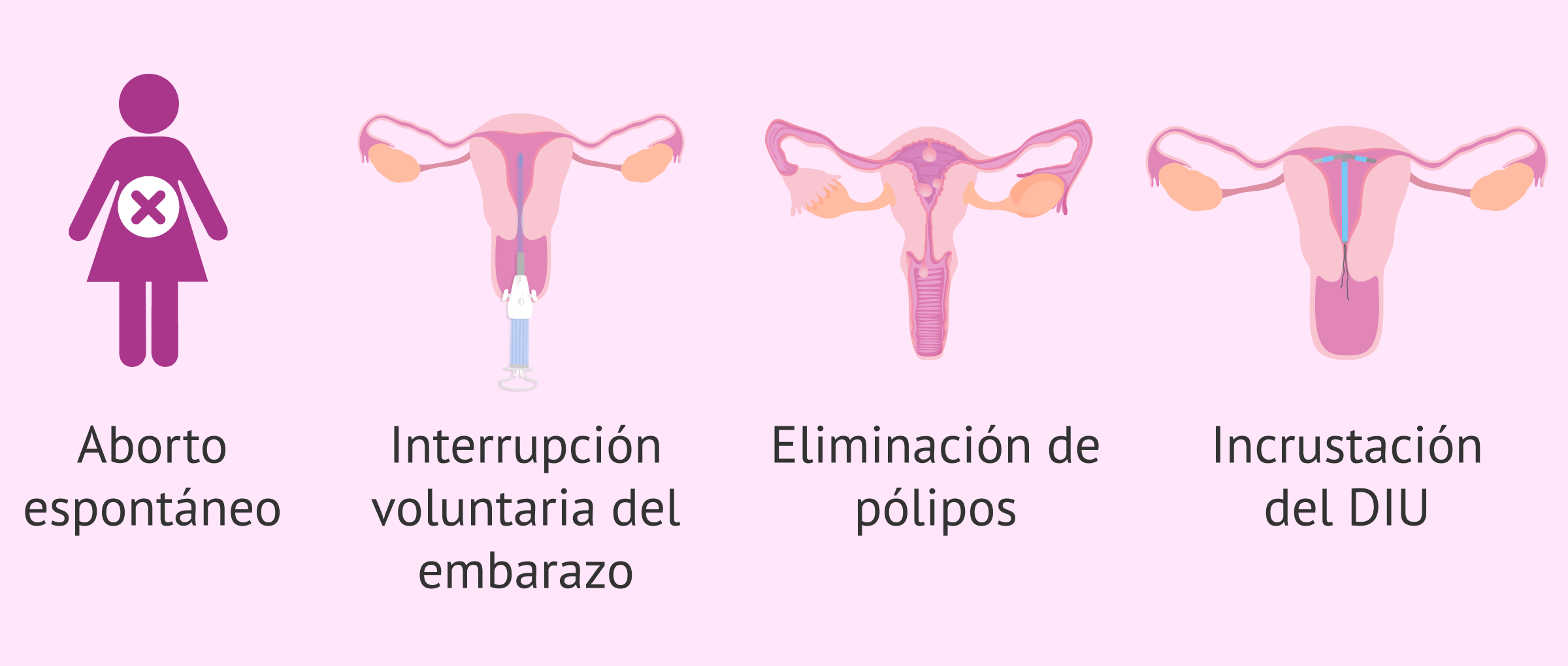Indicaciones para un legrado uterino