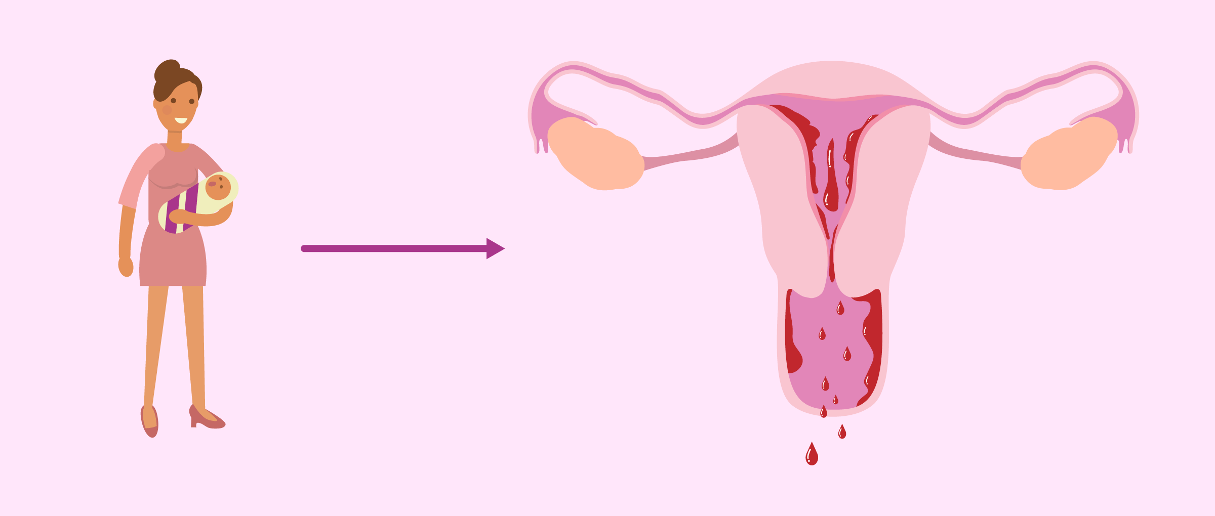 ético Bolos conciencia La menstruación después del parto: ¿cuánto tarda en bajar?