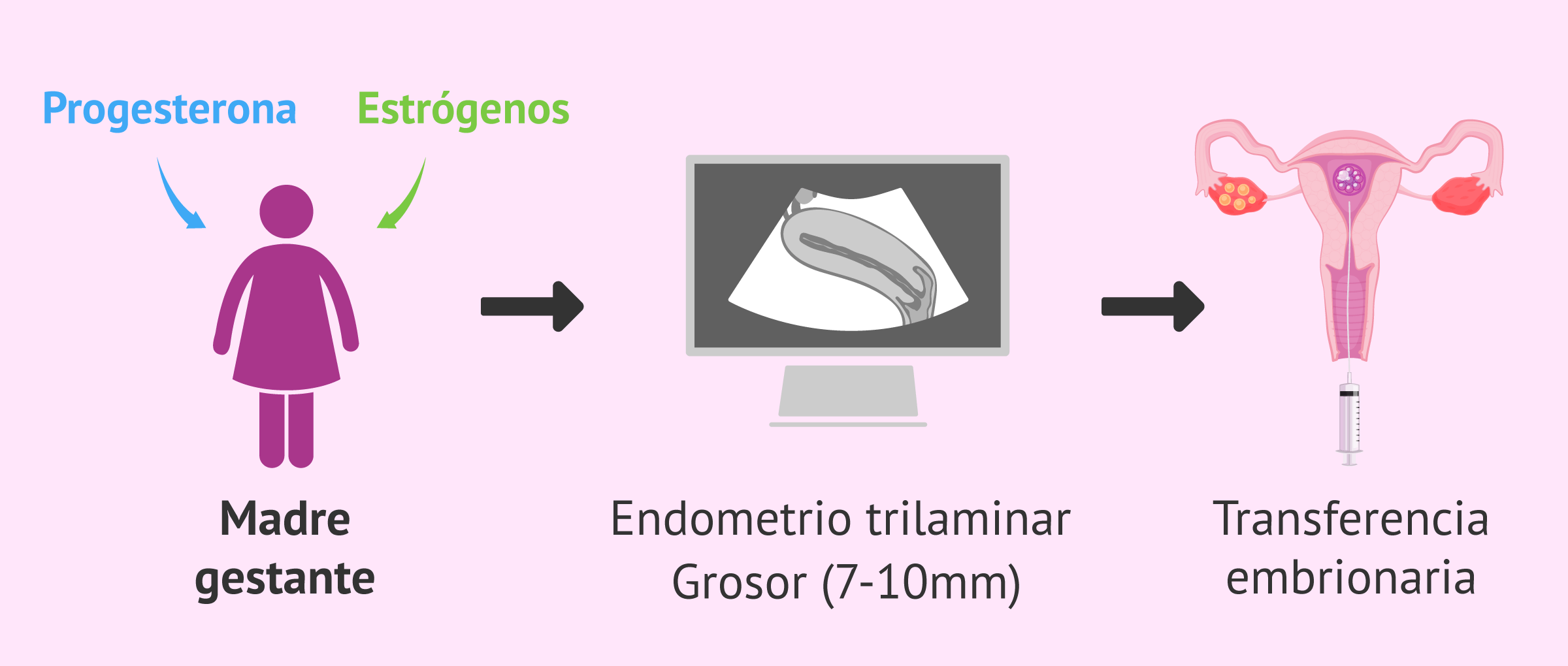 Preparación endometrial y transferencia embrionaria