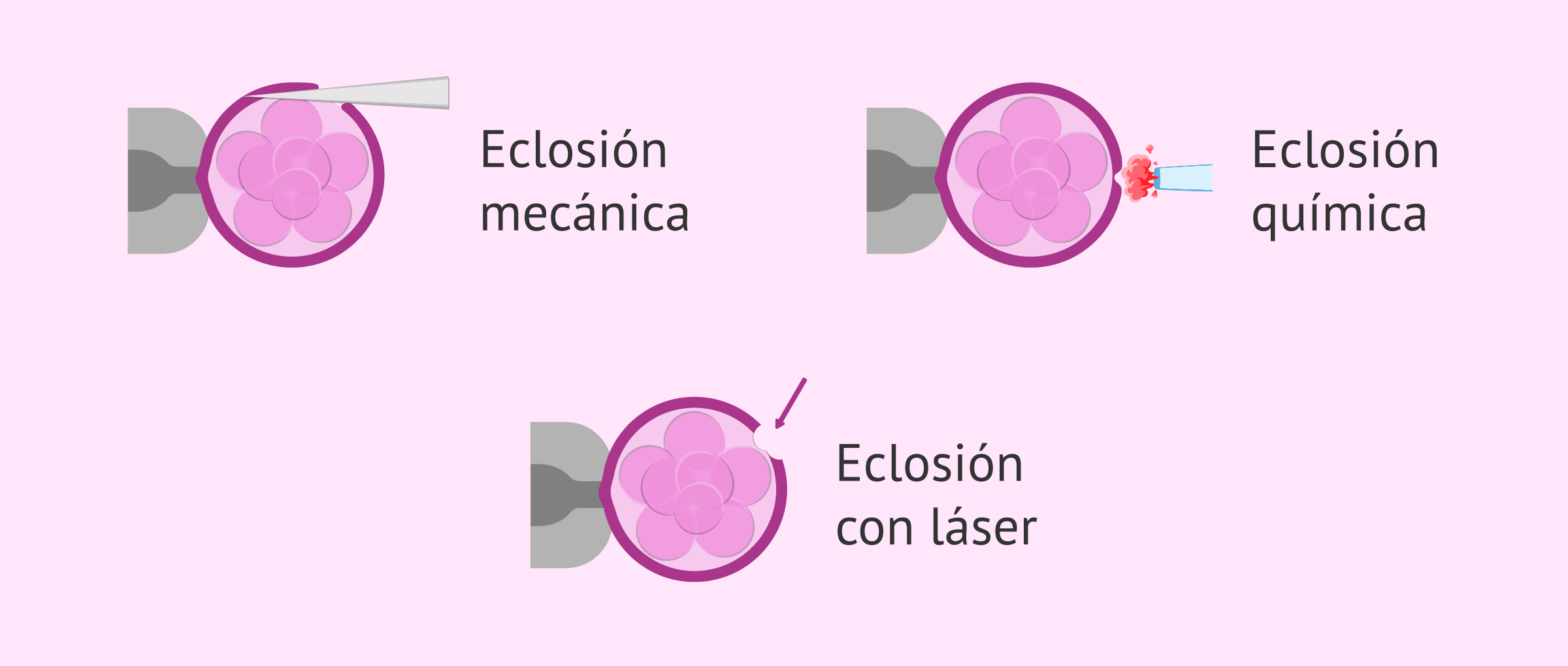 Imagen: Diferentes procedimientos para hacer el hatching asistido