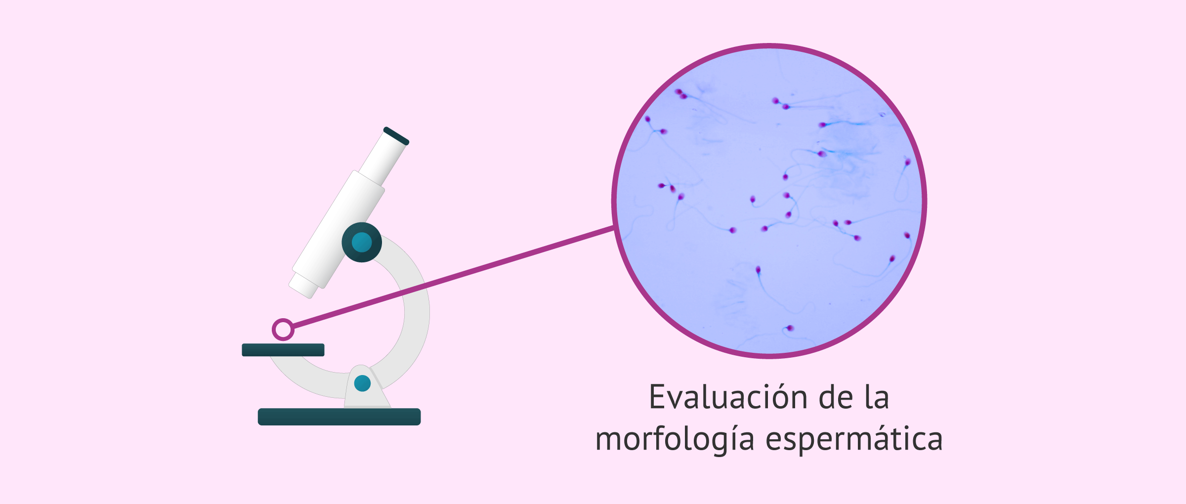 Evaluar la morfología de los espermatozoides