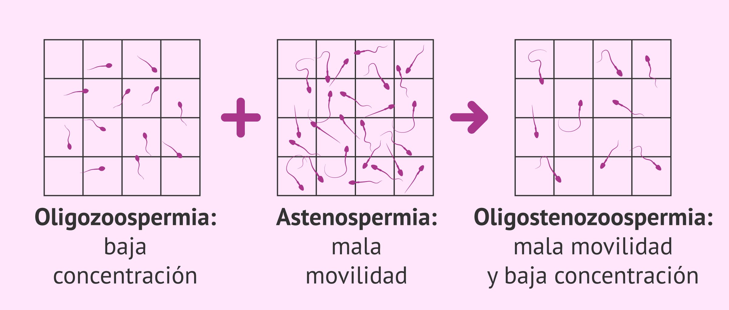Alteración seminal: oligoatenozoospermia