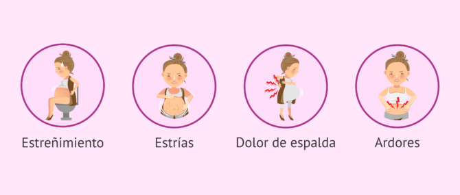 Imagen: ¿Cuáles son los síntomas comunes en la semana 20 de embarazo?