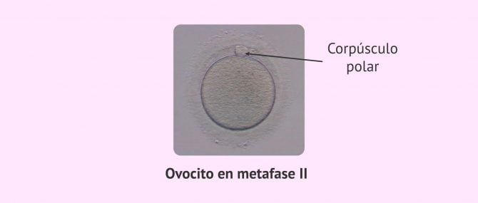 Imagen: ovocito-metafase-II-corpusculo-polar