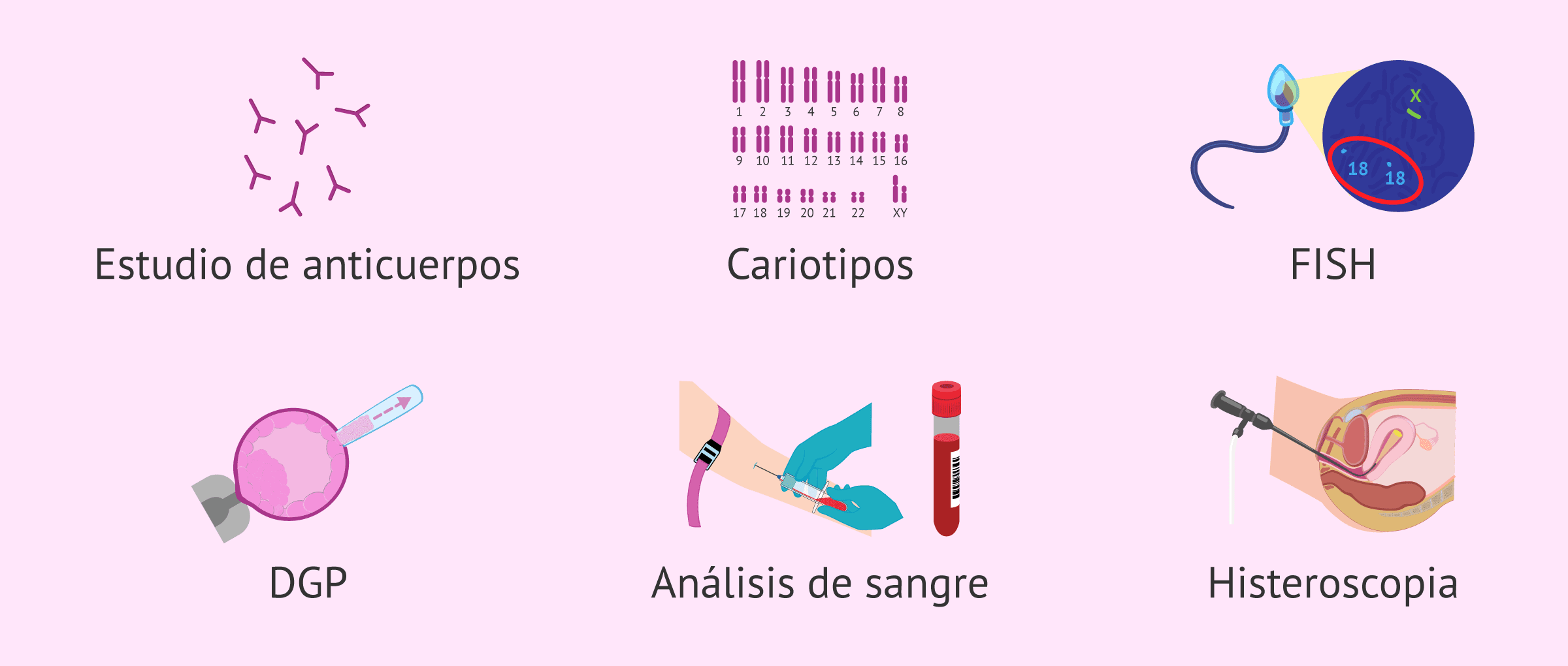 Imagen: ¿Qué pruebas se hacen en casos de abortos de repetición?