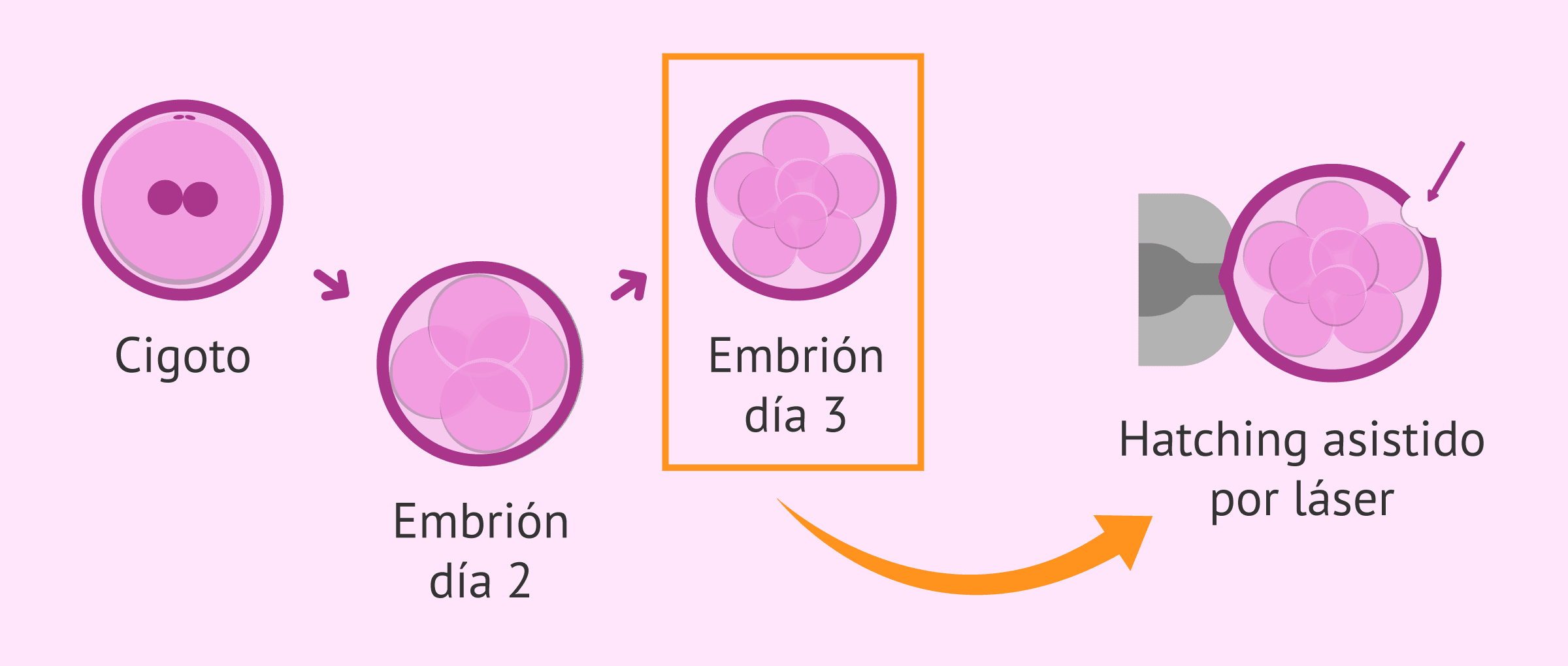 Imagen: ¿En qué consiste el hatching asistido o la eclosión asistida?