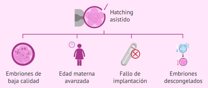 Imagen: Indicaciones hatching asistido