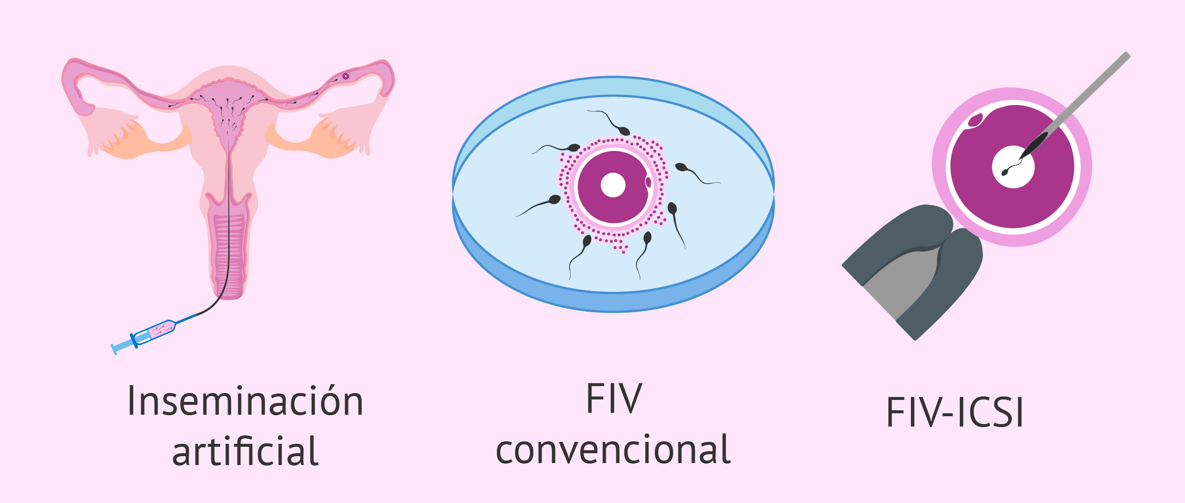 Técnicas de alta y baja complejidad en reproducción asistida