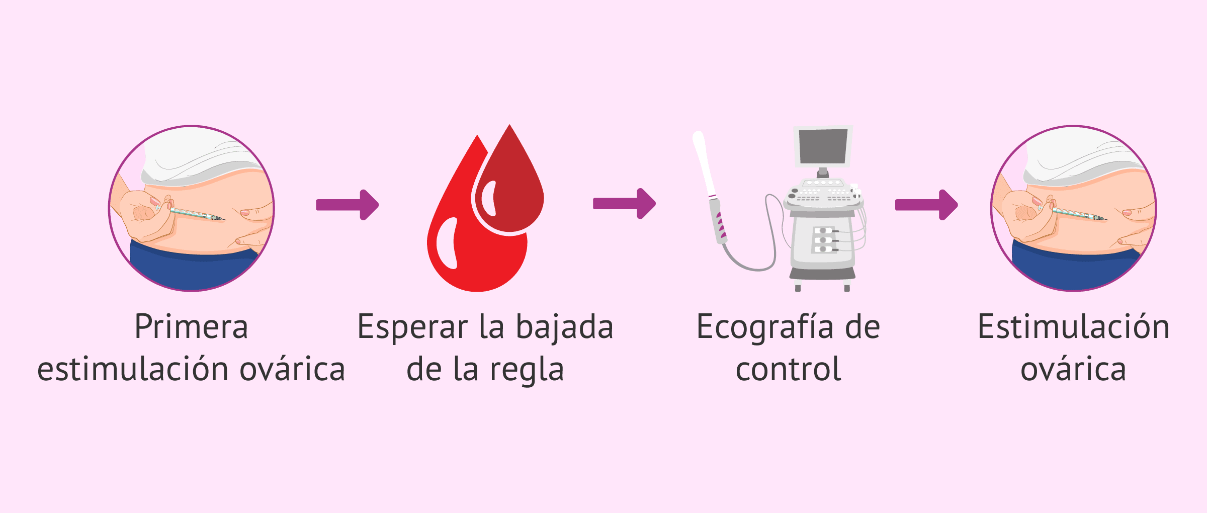 Imagen: Tiempo de espera entre dos estimulaciones