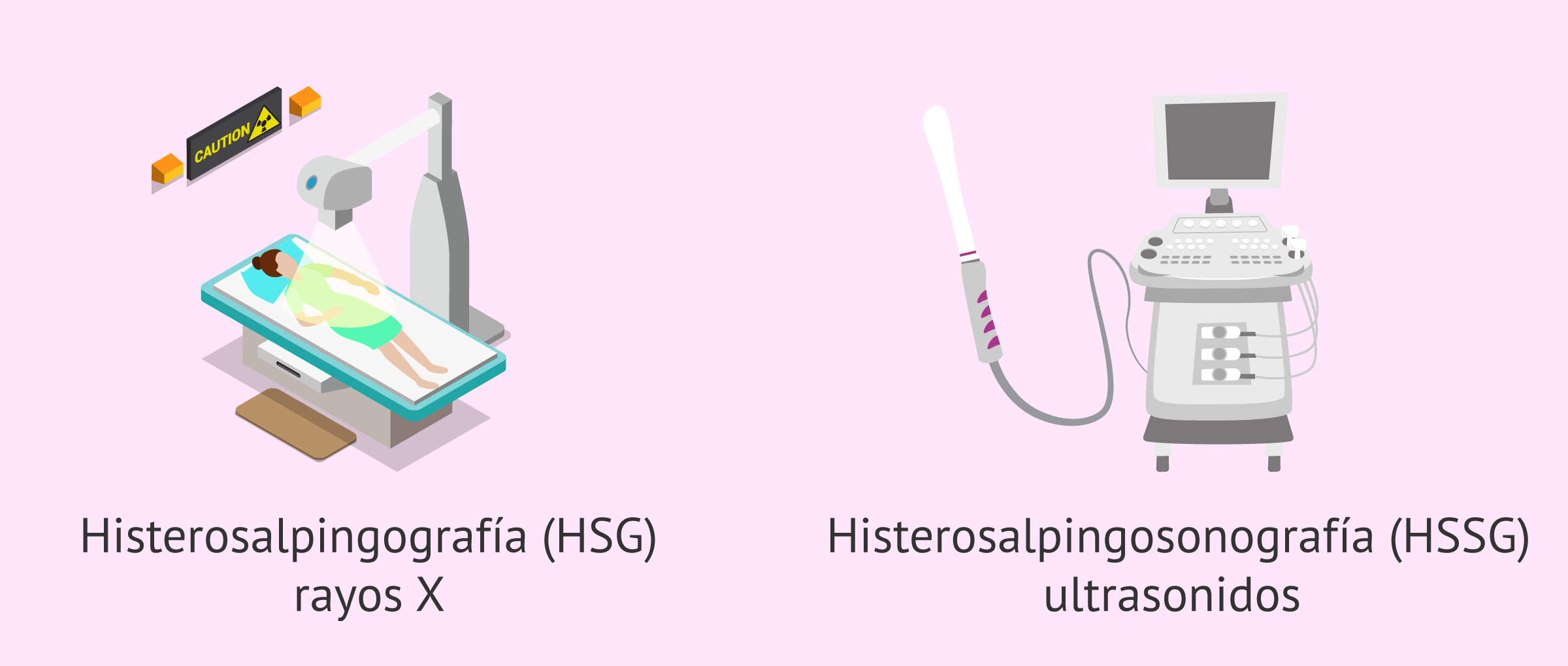 Tipos de histerosalpingografía